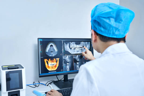 Best Emergency Root Canal Treatment in South Monrovia Island, CA