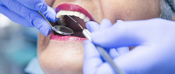 Best Broken or Cracked Tooth Emergency Dentist in South Monrovia Island, CA